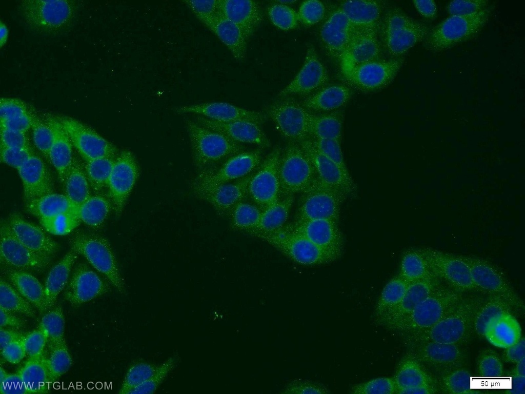 STAT5B Polyclonal antibody