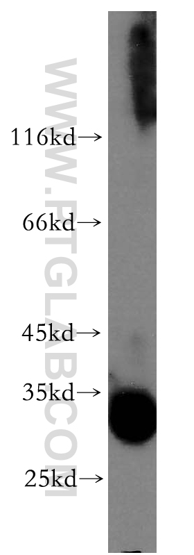 TRA2A Polyclonal antibody