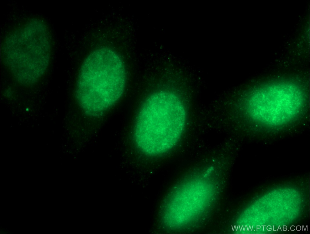 HMG20A Polyclonal antibody