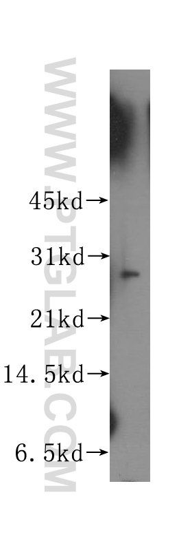 APIP Polyclonal antibody