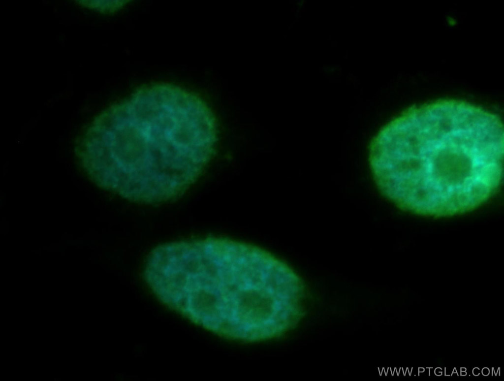 STK3 Polyclonal antibody