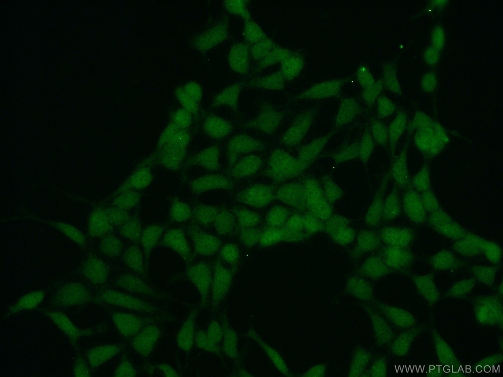 SPIN1 Polyclonal antibody