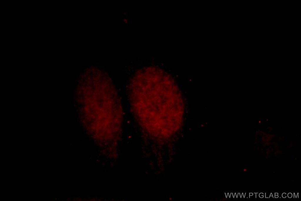 DPF2 Polyclonal antibody