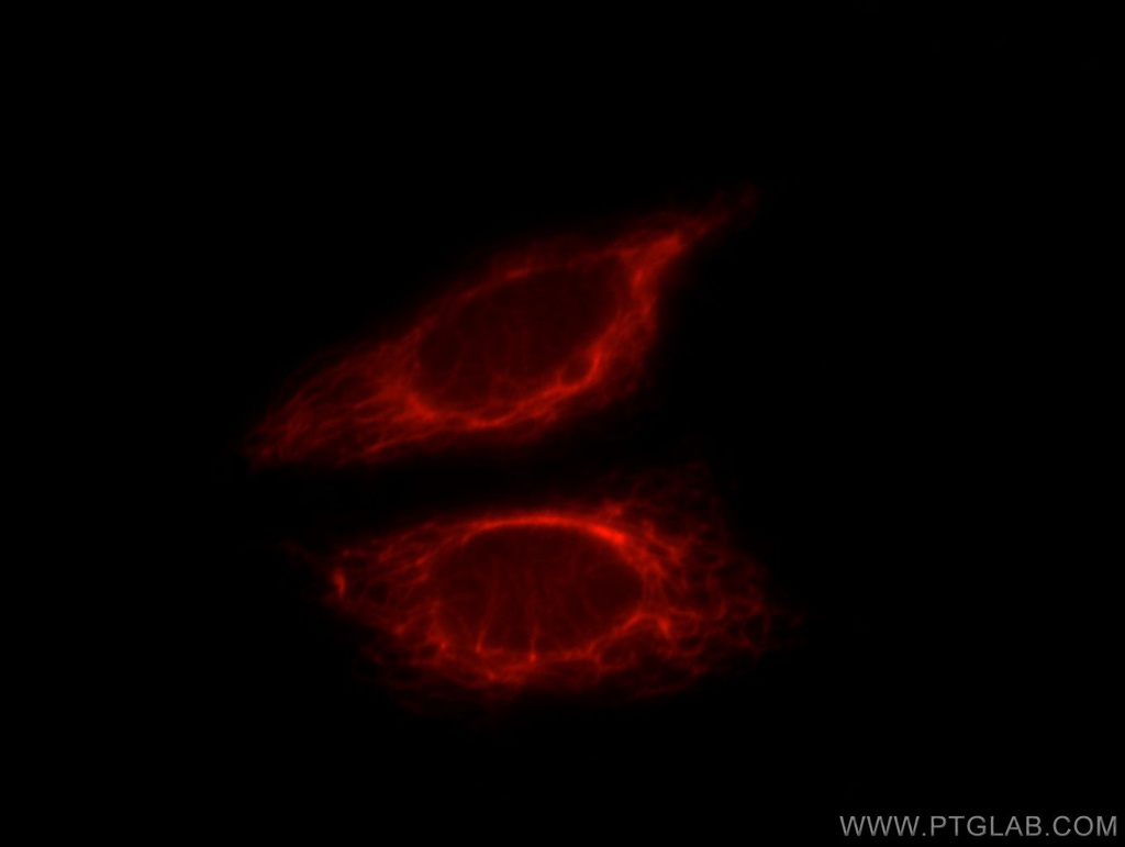 WSB2 Polyclonal antibody