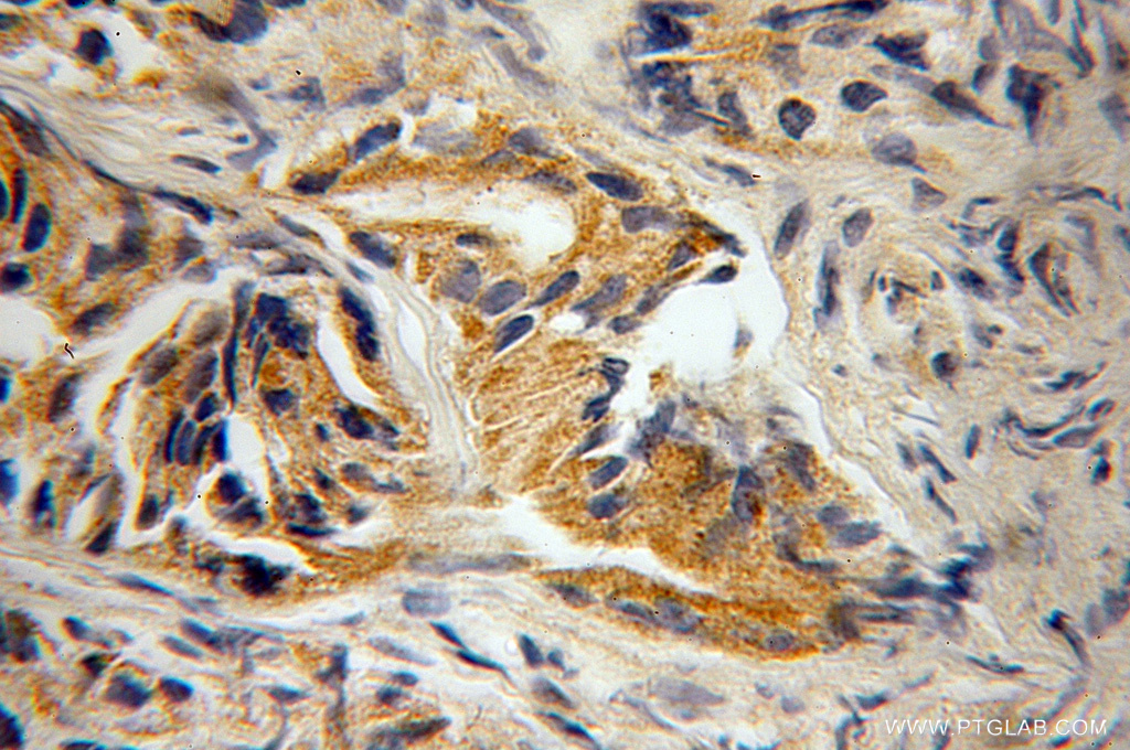 RAB22A Polyclonal antibody
