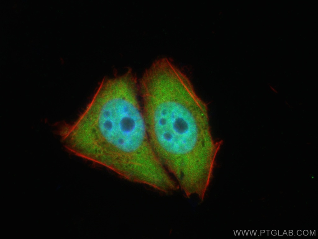 TIA1 Polyclonal antibody