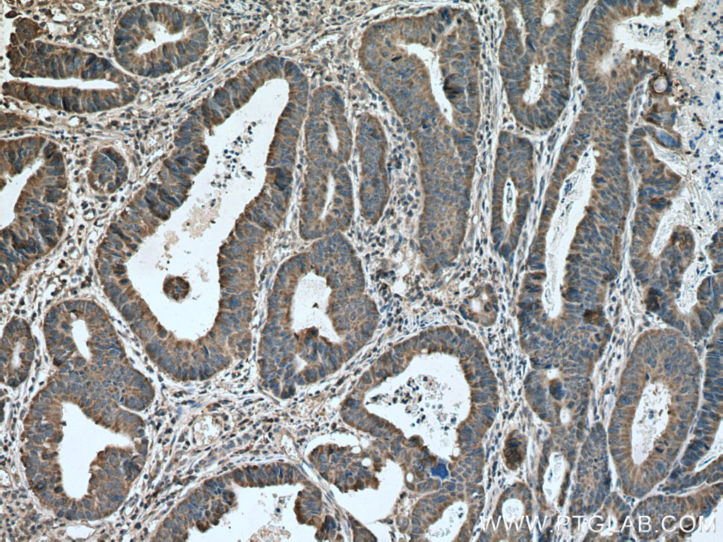 NXT2 Polyclonal antibody