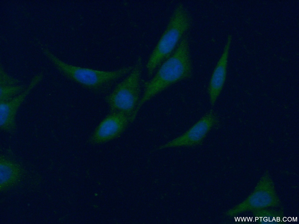 CCBL1/KAT1 Polyclonal antibody