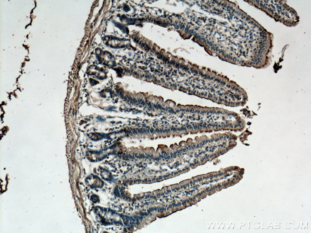 TCN2 Polyclonal antibody