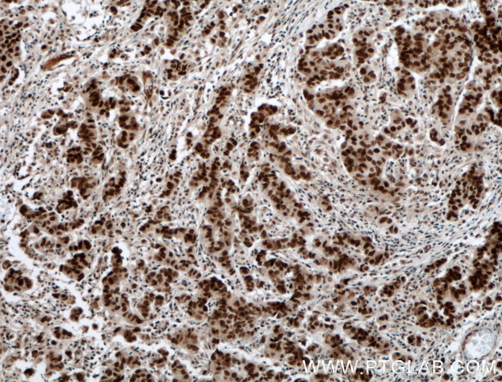 RTF1 Polyclonal antibody