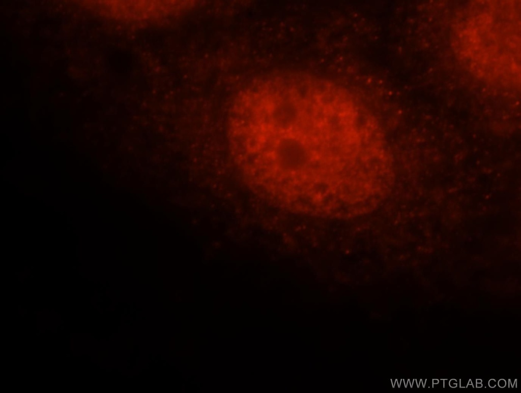 FAM107A Polyclonal antibody