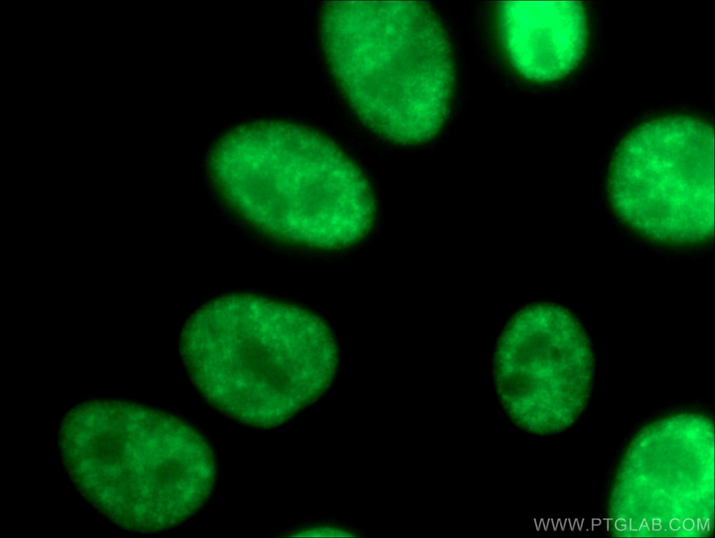 SMNDC1 Polyclonal antibody