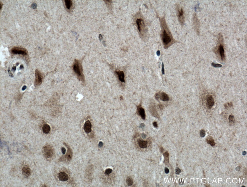 MED8 Polyclonal antibody