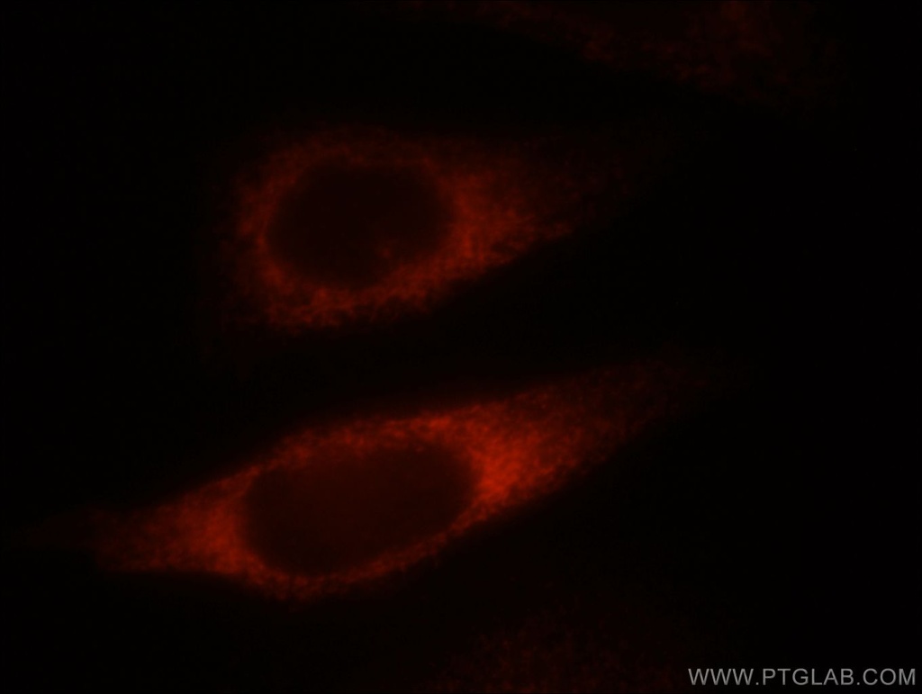 NDRG4 Polyclonal antibody