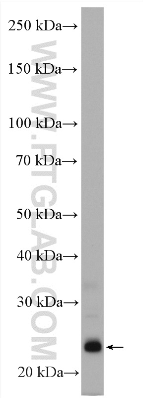 Endothelin 1 Polyclonal antibody