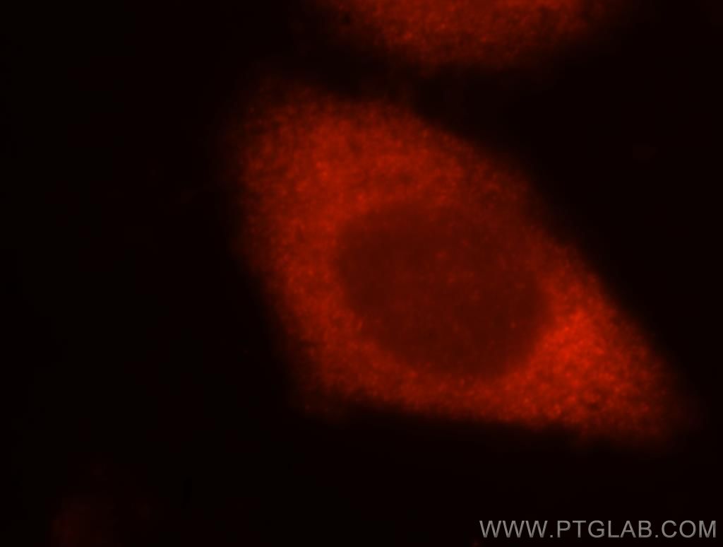 TOMM34 Polyclonal antibody