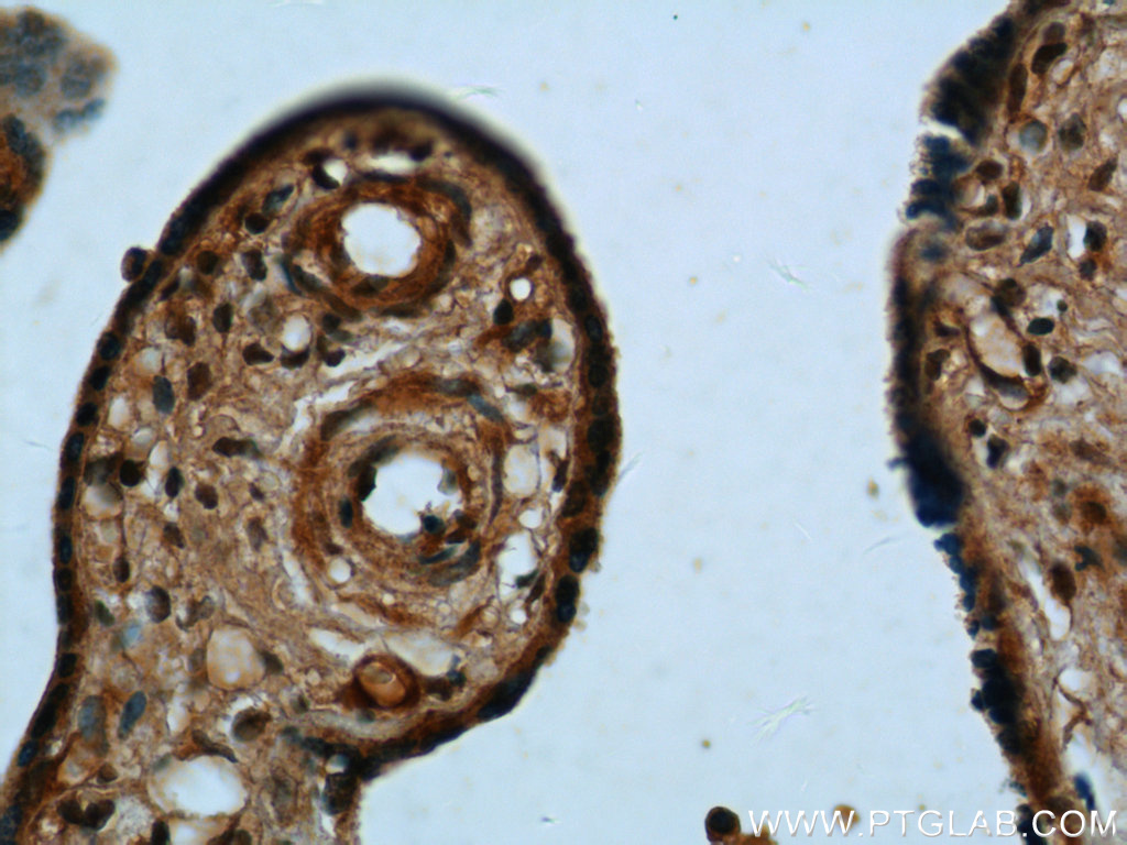 UCN2 Polyclonal antibody