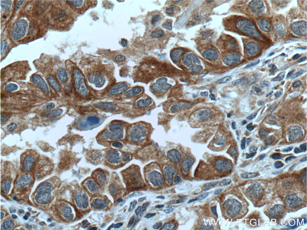 USP25 Polyclonal antibody