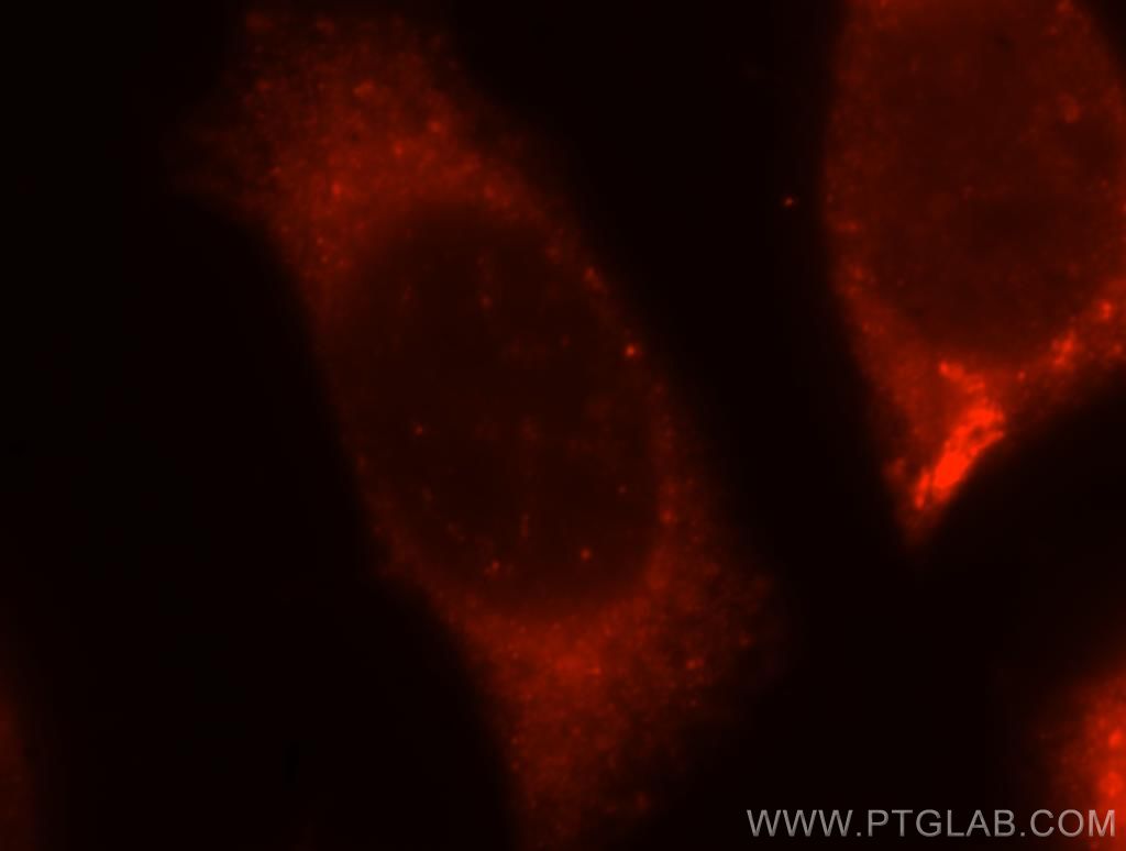 ABHD5 Polyclonal antibody