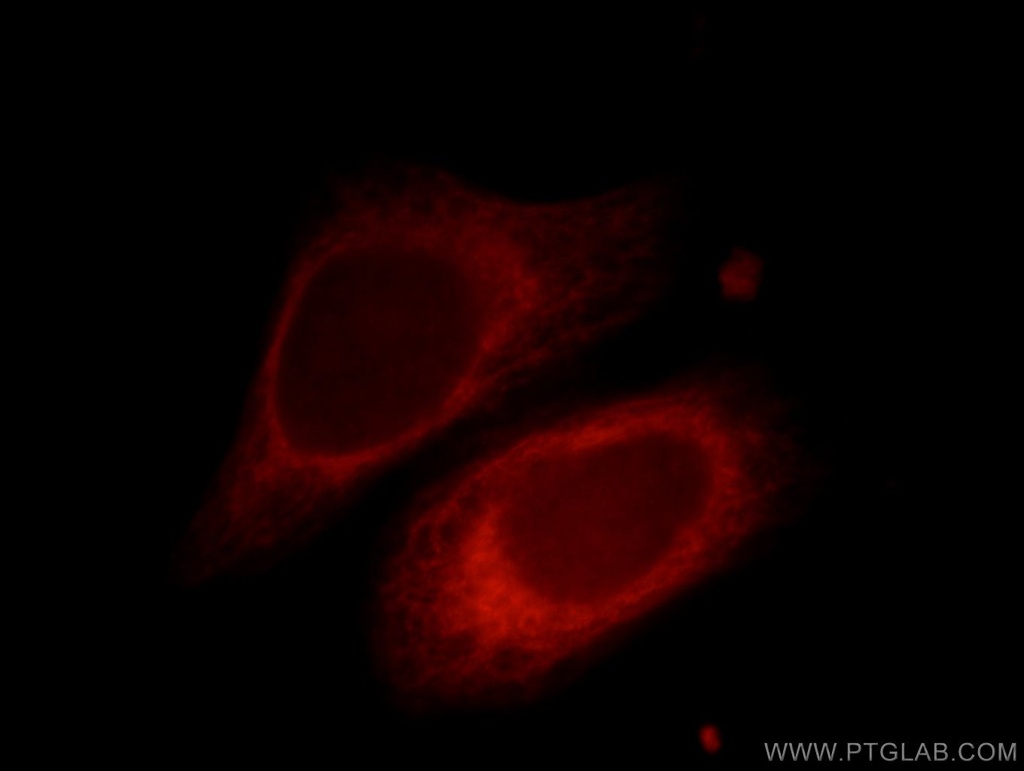 PRKACB Polyclonal antibody