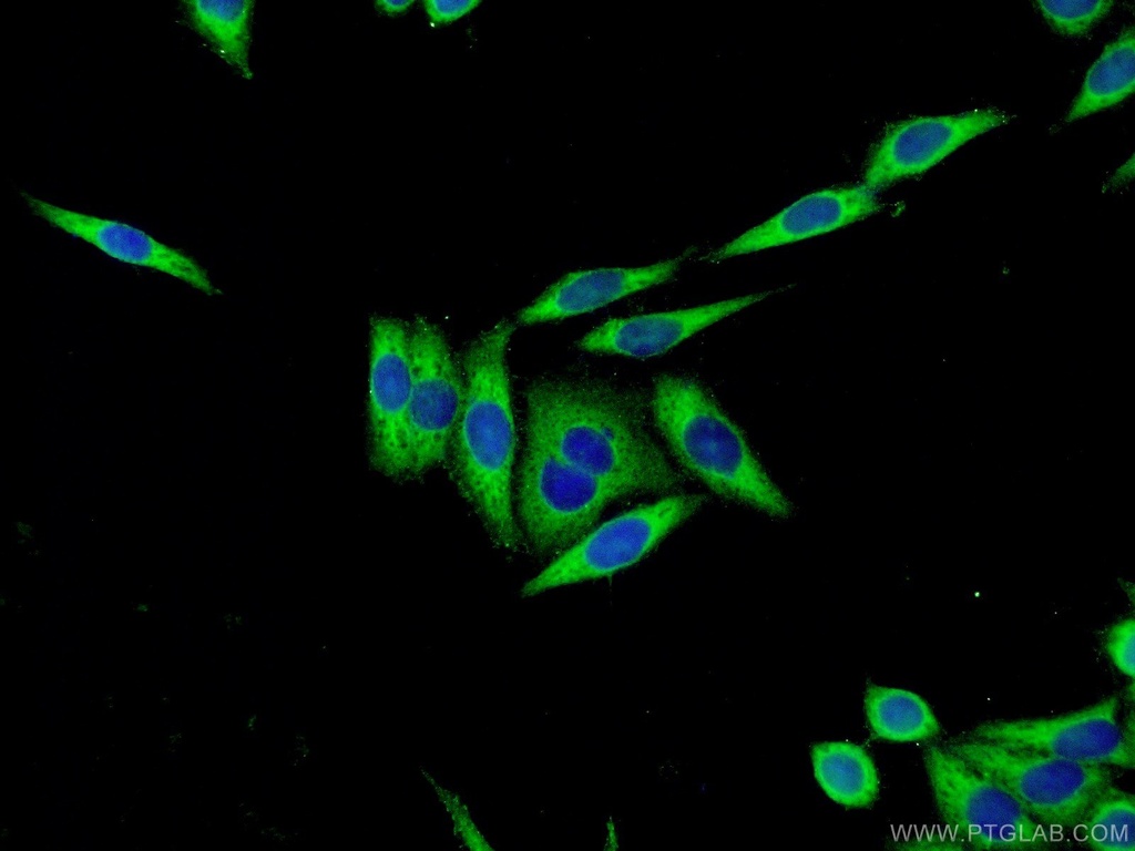 Cystatin C Polyclonal antibody