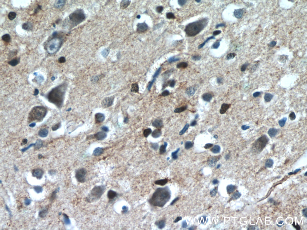 CHURC1 Polyclonal antibody