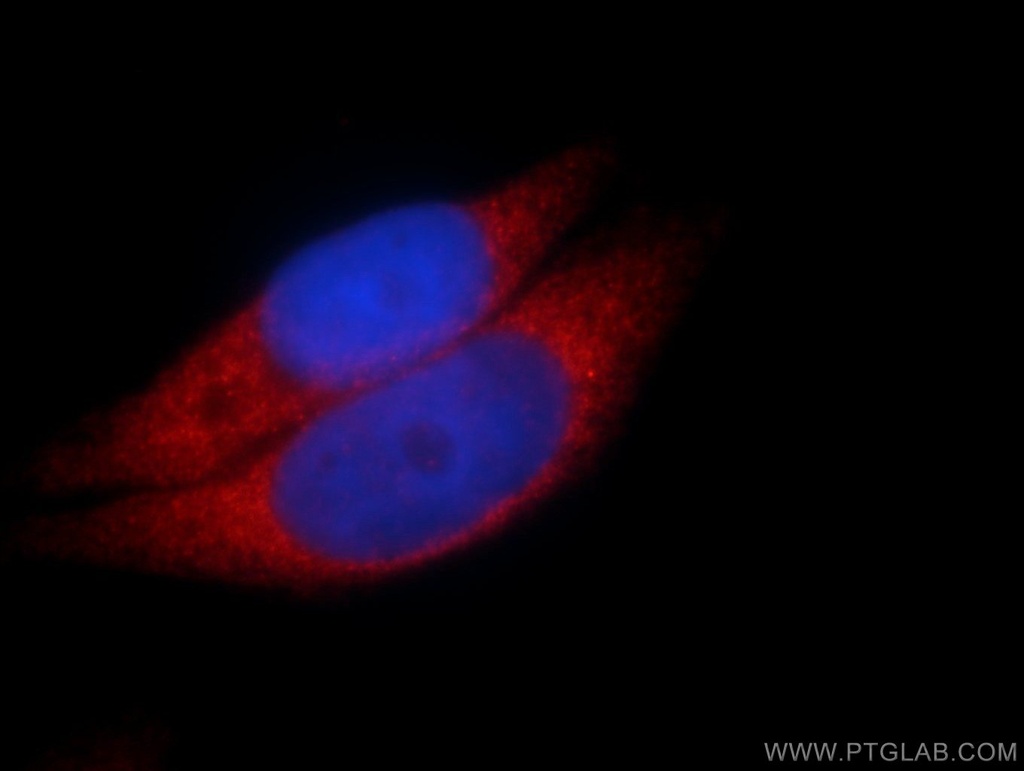 Calpastatin Polyclonal antibody
