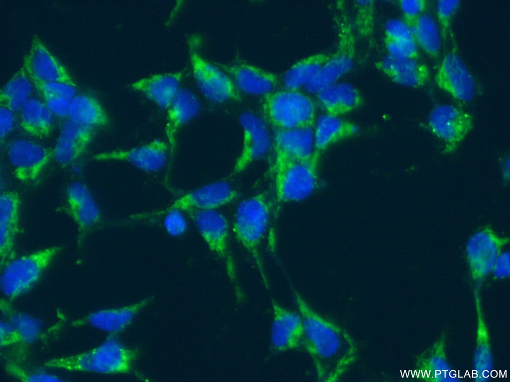 SLC25A11 Polyclonal antibody