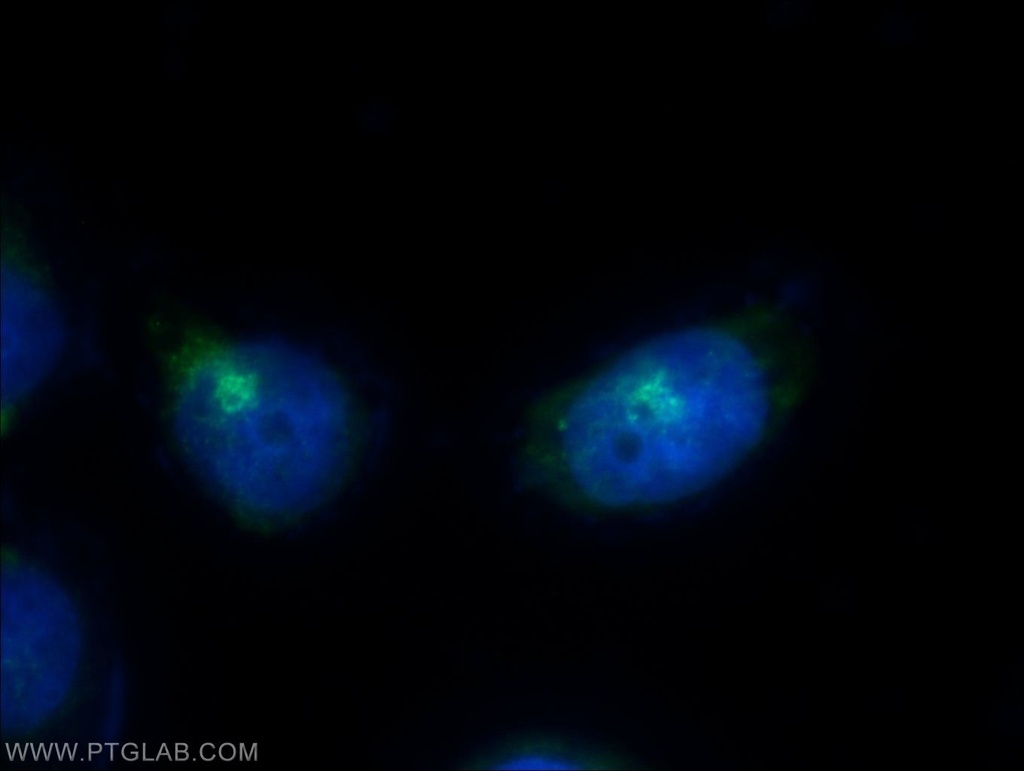 RCAS1 Polyclonal antibody