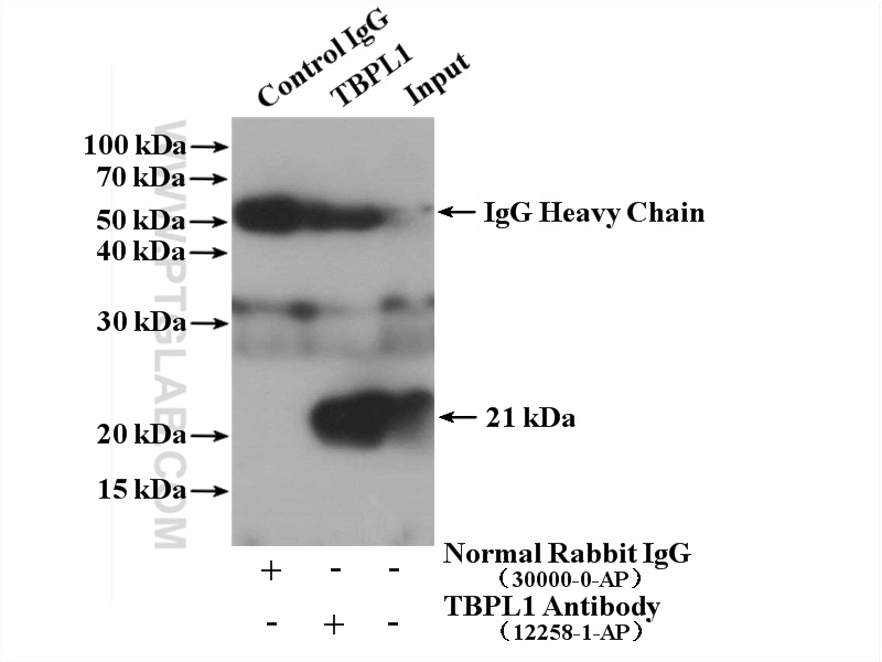 TBPL1 Polyclonal antibody