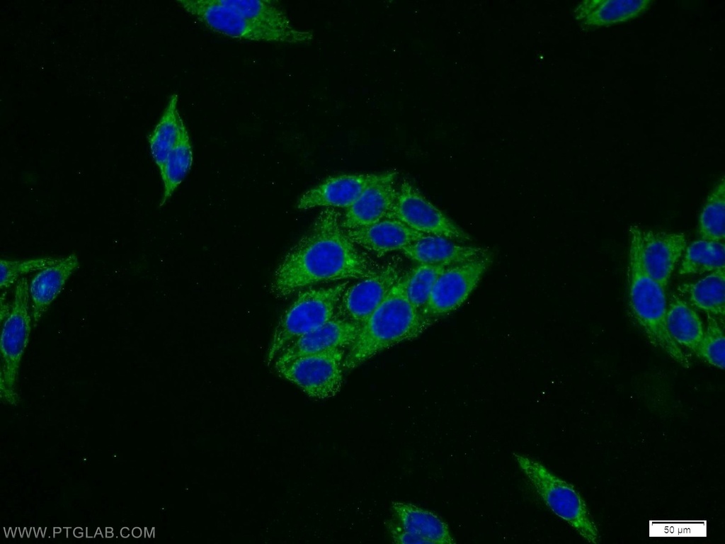 SERPING1/C1 Inactivator Polyclonal antibody