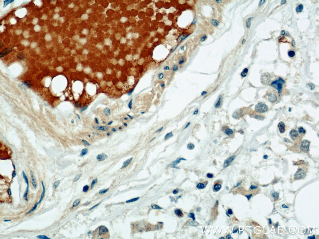 SULF2 Polyclonal antibody