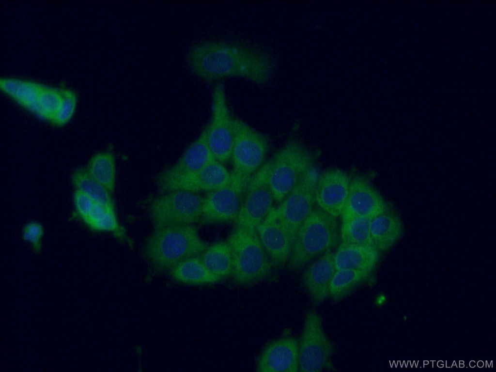CCT8 Polyclonal antibody