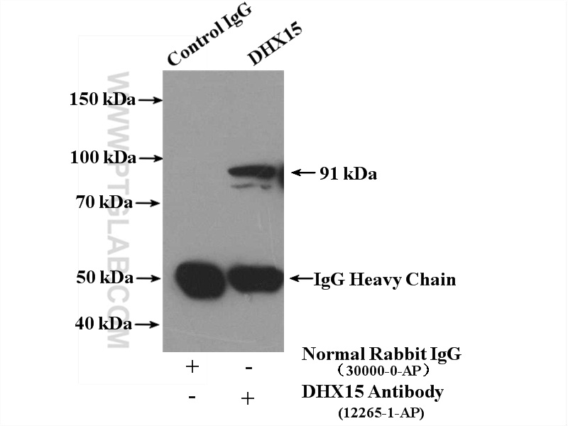 DHX15 Polyclonal antibody