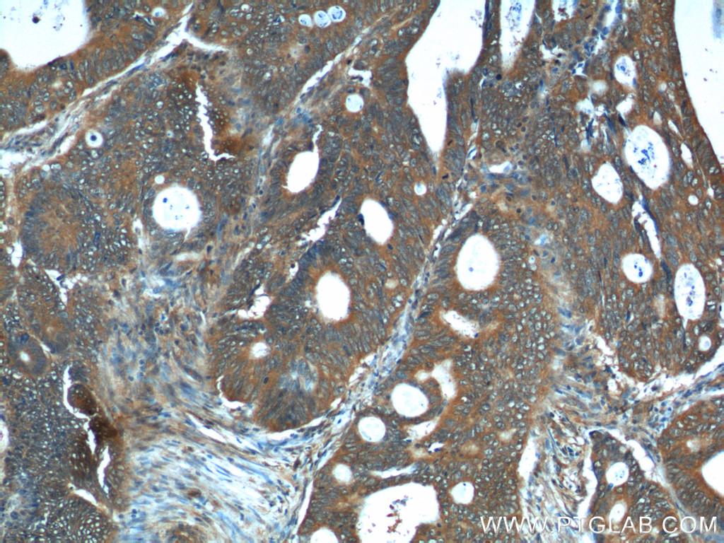 REG4 Polyclonal antibody