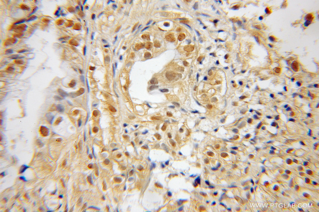 SNX7 Polyclonal antibody