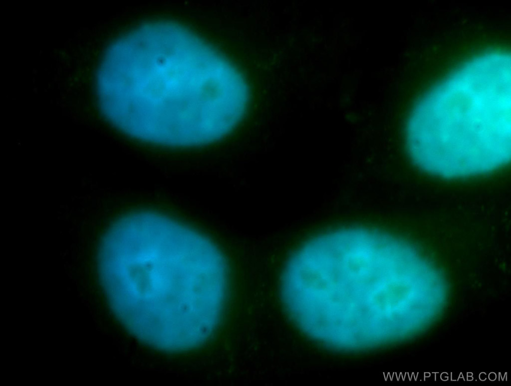ZWINT Polyclonal antibody