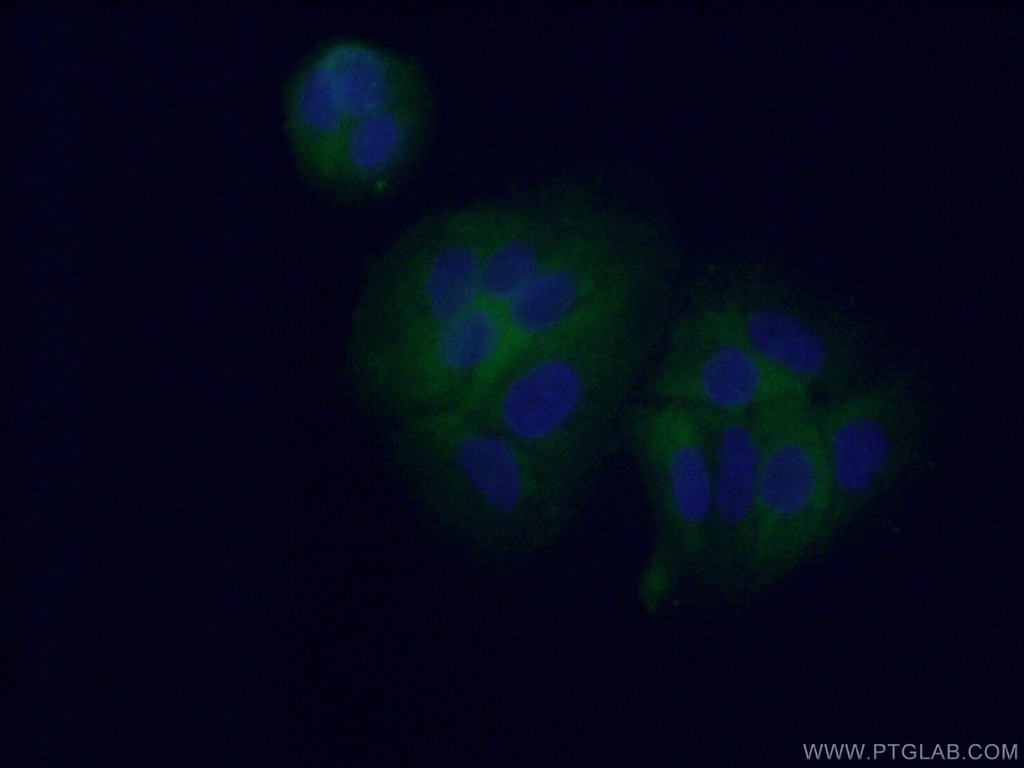 CYP4F11 Polyclonal antibody