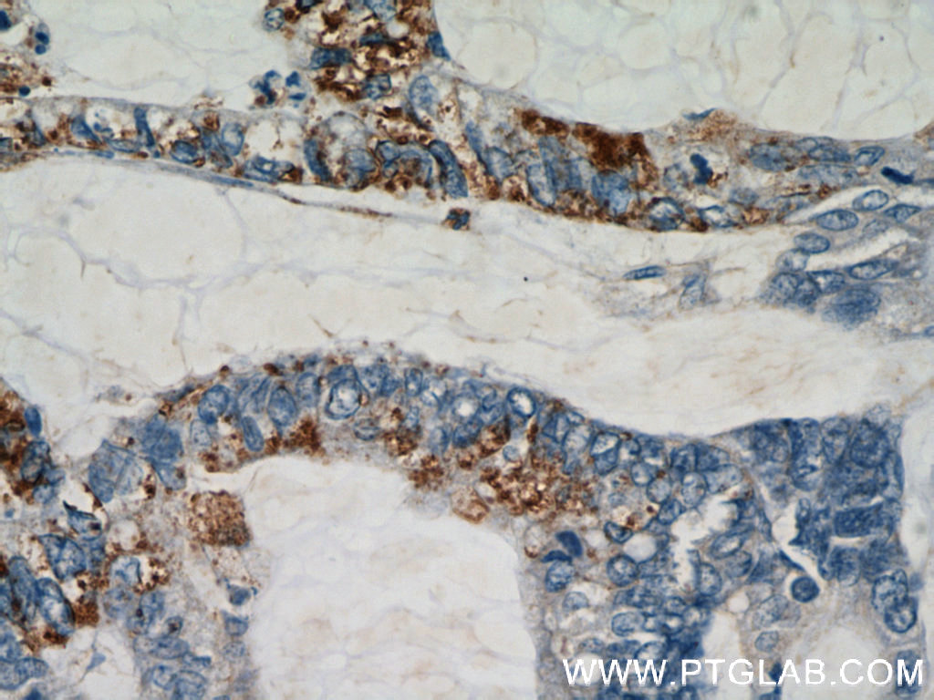 RHOF Polyclonal antibody