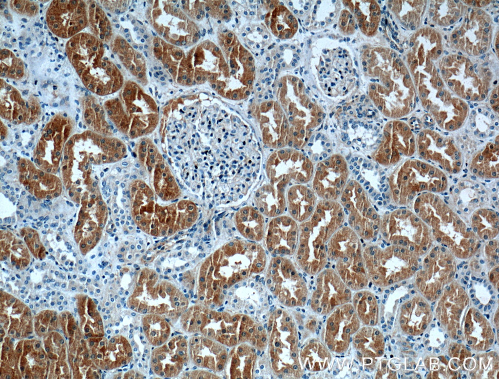 CLIC4 Polyclonal antibody