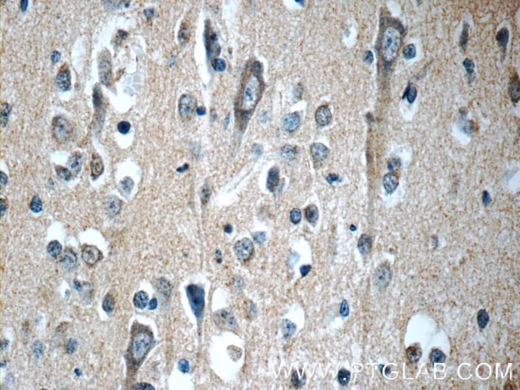 APLP1 Polyclonal antibody