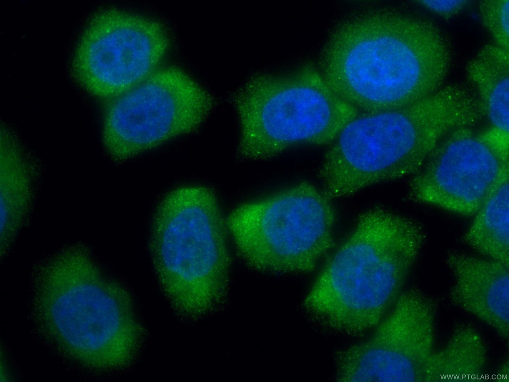 GEMIN6 Polyclonal antibody
