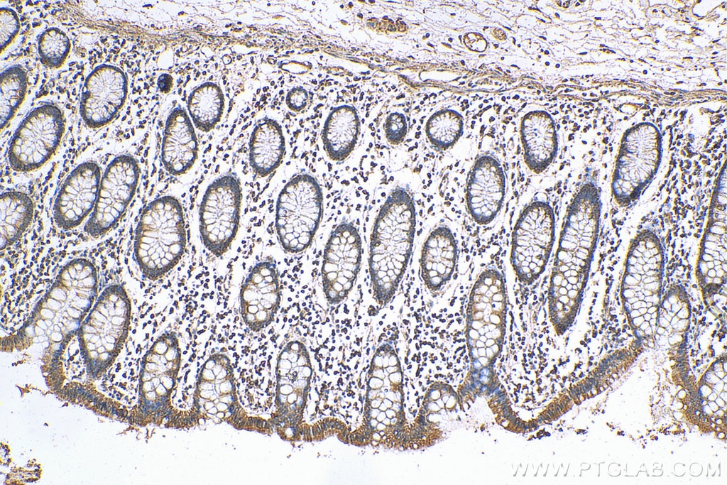 ANGPTL2 Polyclonal antibody