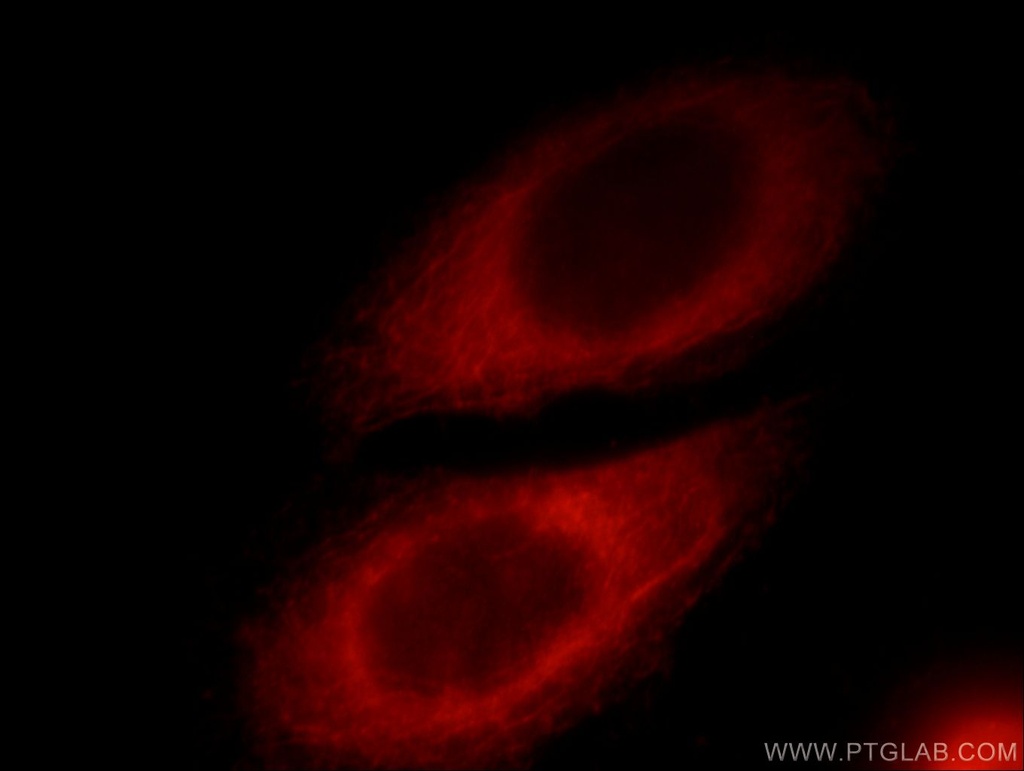 RAB3IP/Rabin8 Polyclonal antibody