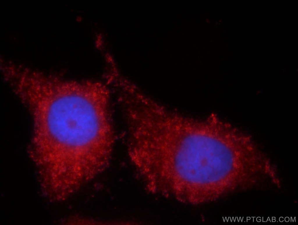 TIMP-4 Polyclonal antibody