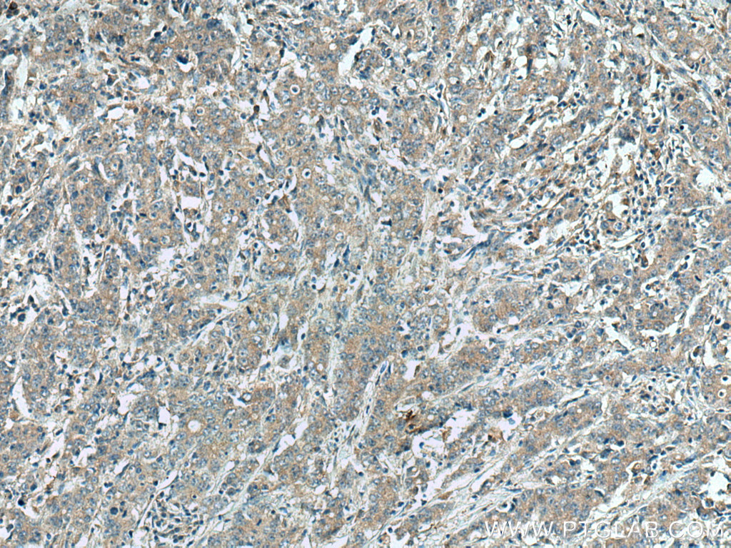 DNAJC12 Polyclonal antibody