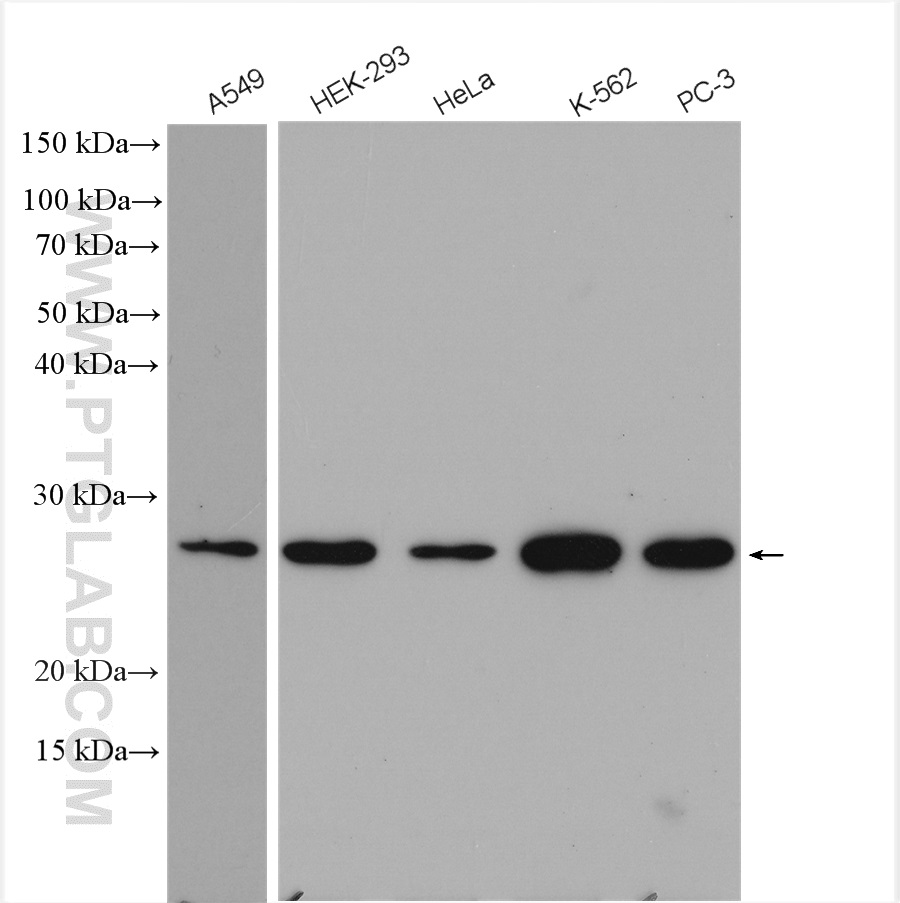 PSMD10 Polyclonal antibody