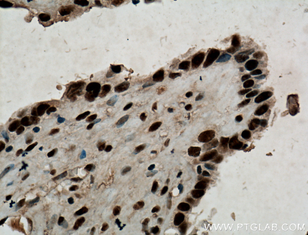 MAGOH Polyclonal antibody