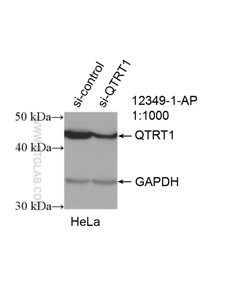 QTRT1 Polyclonal antibody