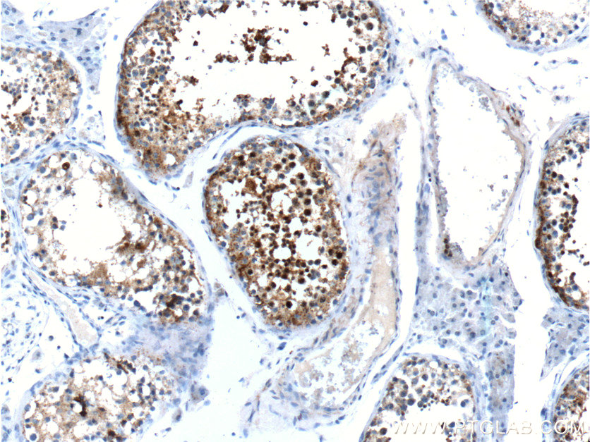 CABYR Polyclonal antibody